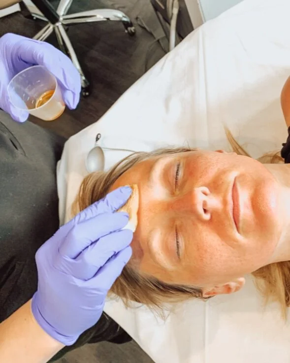IPL Intense Pulsed Light — Jack Zamora MD Cosmetic Surgery and